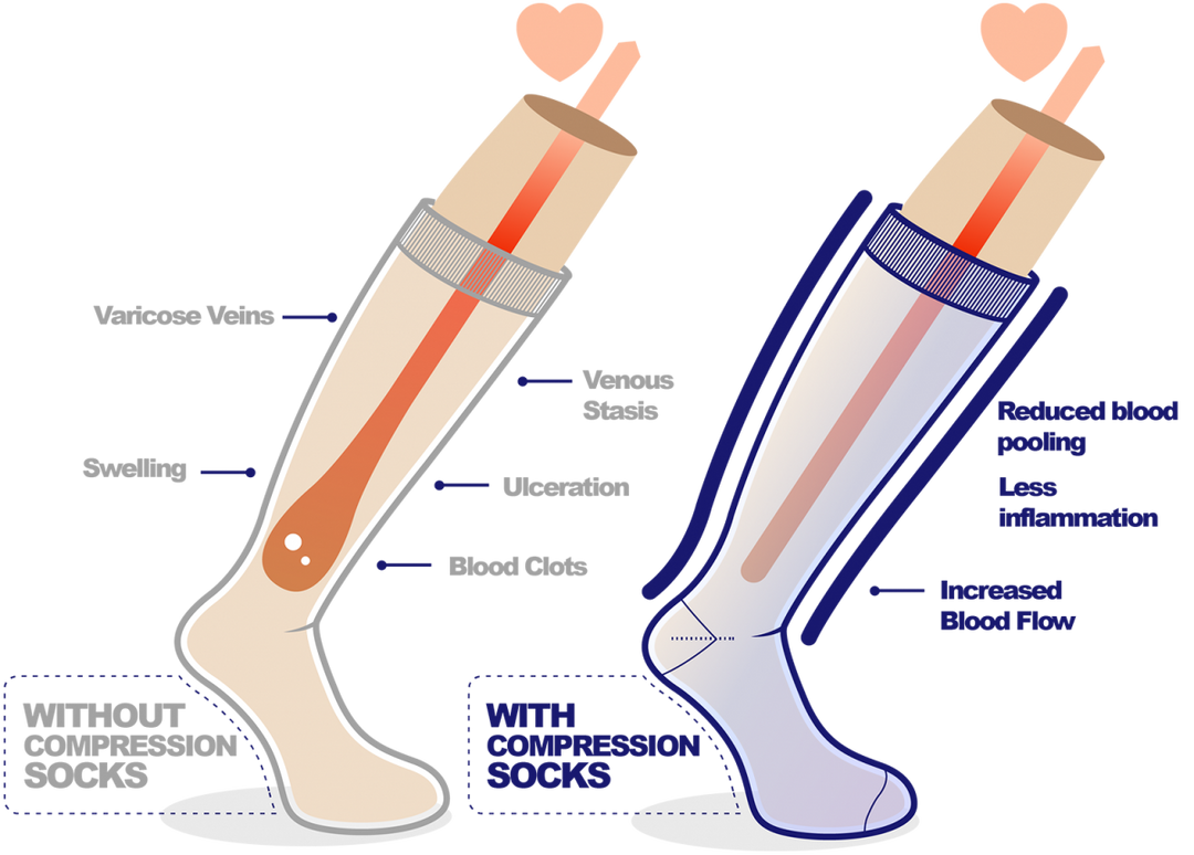 How to Choose the Best Compression Level